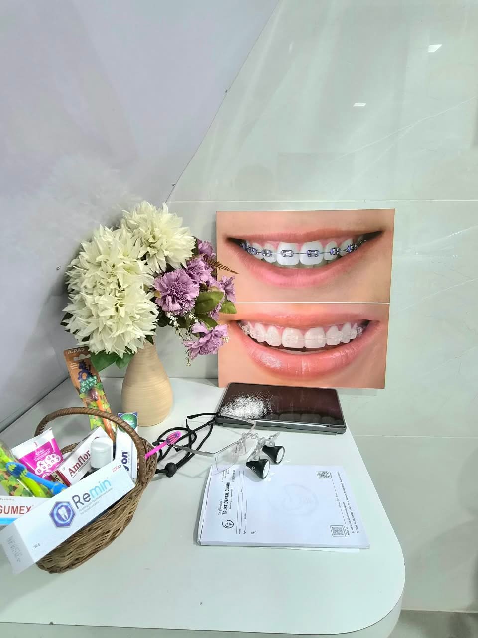 Orthodontic braces treatment - before and after
